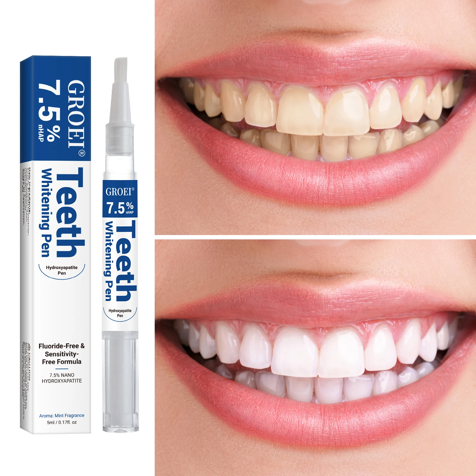 Hydroxyapatite Tooth Whitening - Teeth Whitening Hydrogen Peroxide reseña y precio