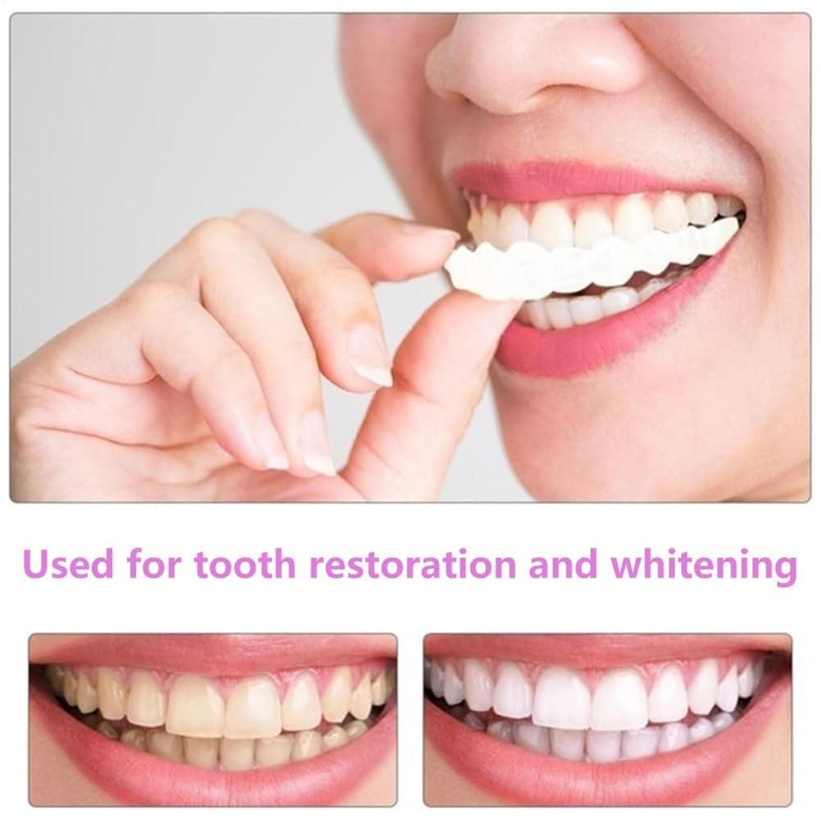 1pair Long-Term Veneers Teeth  - Teeth Whitening Fast reseña y precio