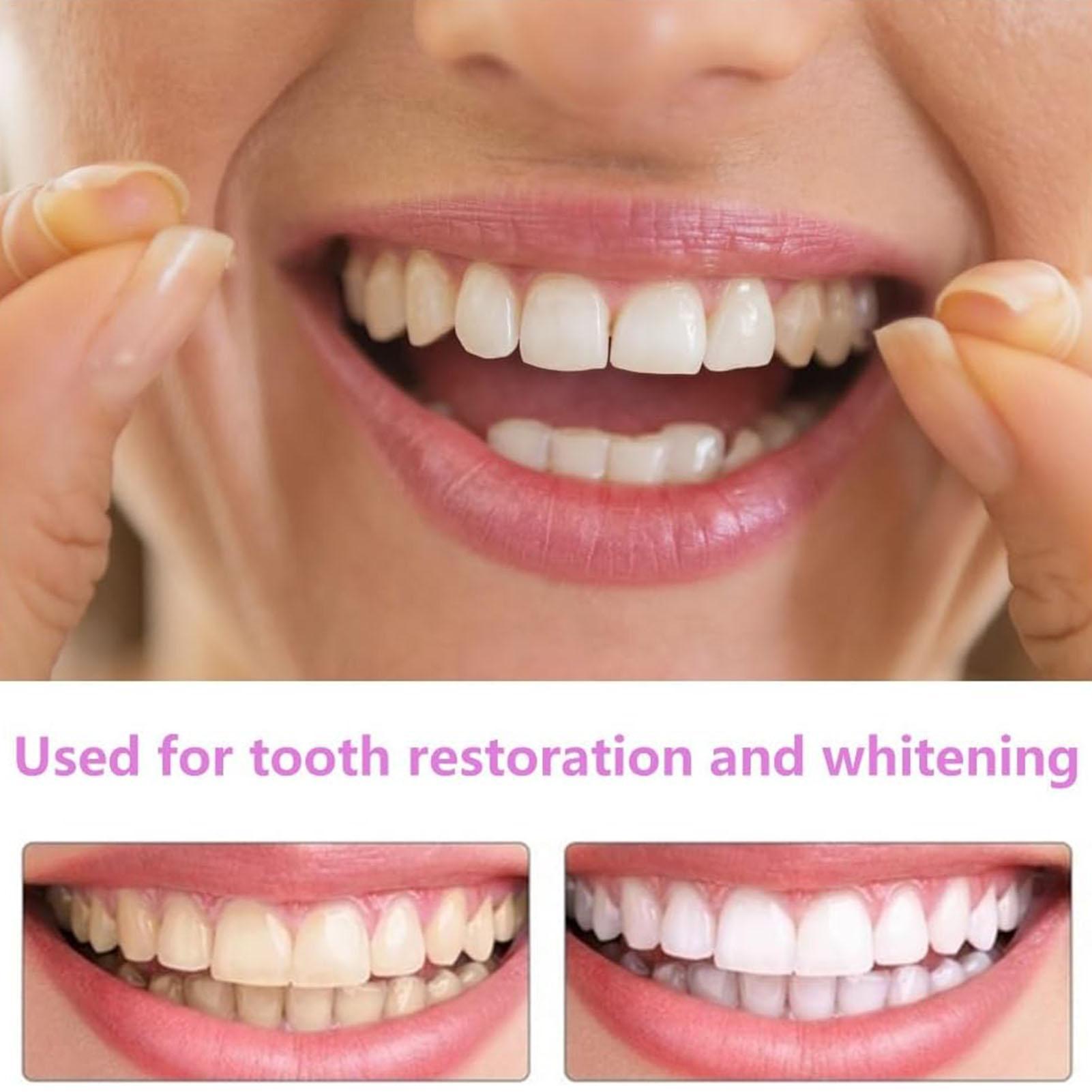 1pair Long-Term Veneers Teeth  - Teeth Whitening Fast reseña y precio