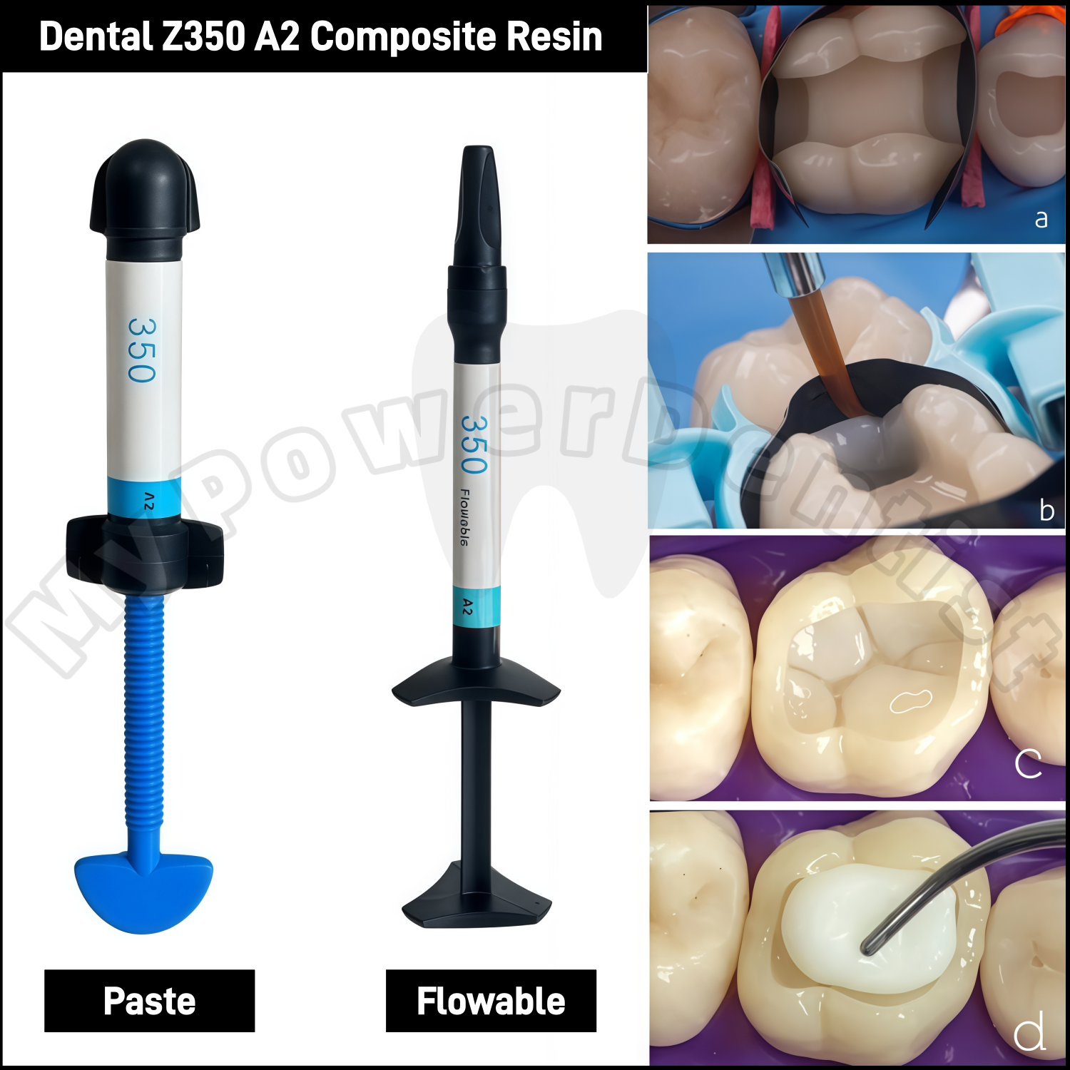 Z350 A2  Dental Composite Resi - Teeth Whitening Veneers reseña y precio