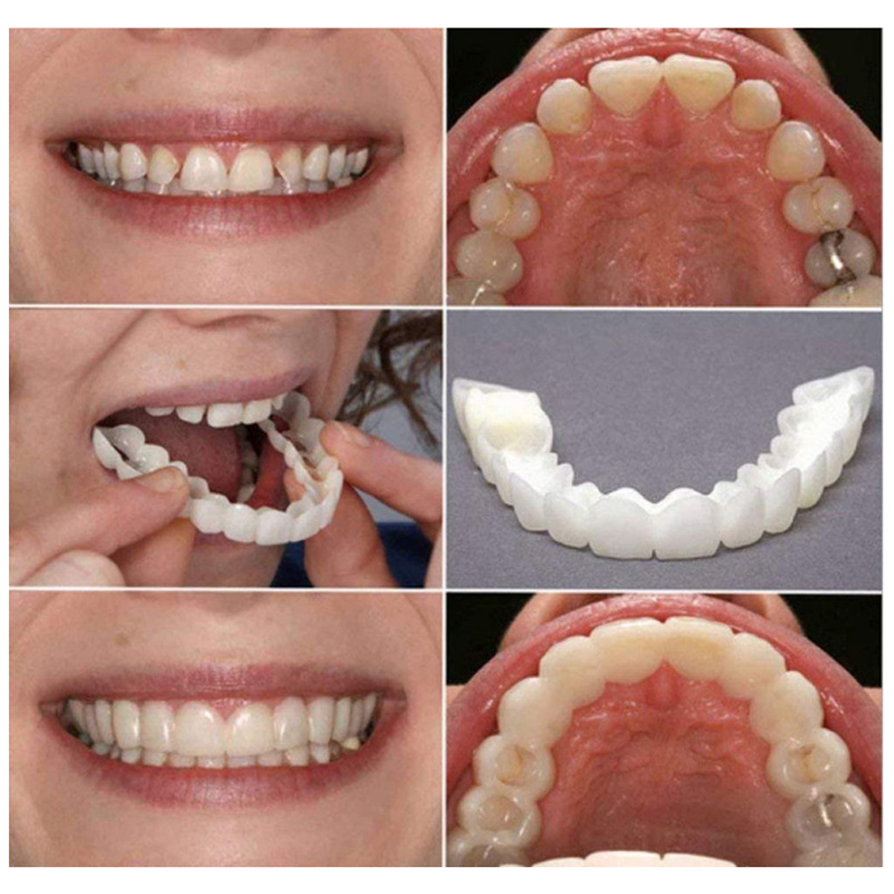 Silicone Denture Set Fit Tempo - Teeth Whitening Usa reseña y precio