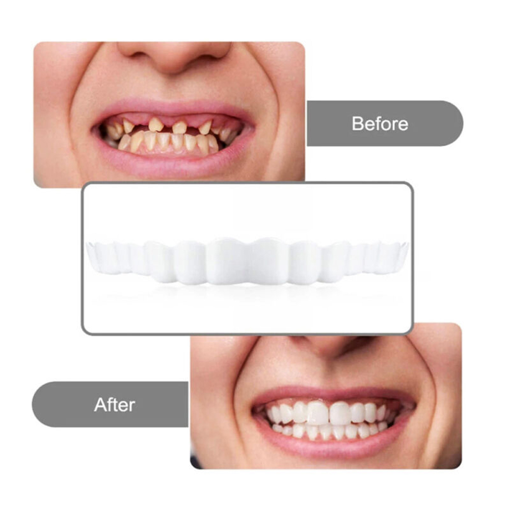 Silicone Denture Set Fit Tempo - Teeth Whitening Usa reseña y precio