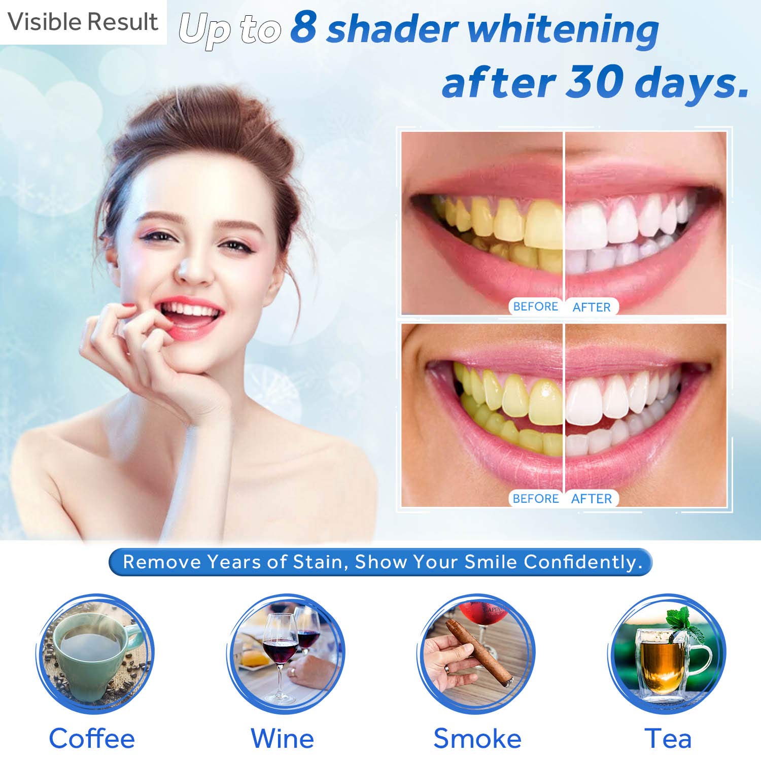 Teeth Whitening Gel Refill Syr - Teeth Whitening Hydrogen Peroxide reseña y precio