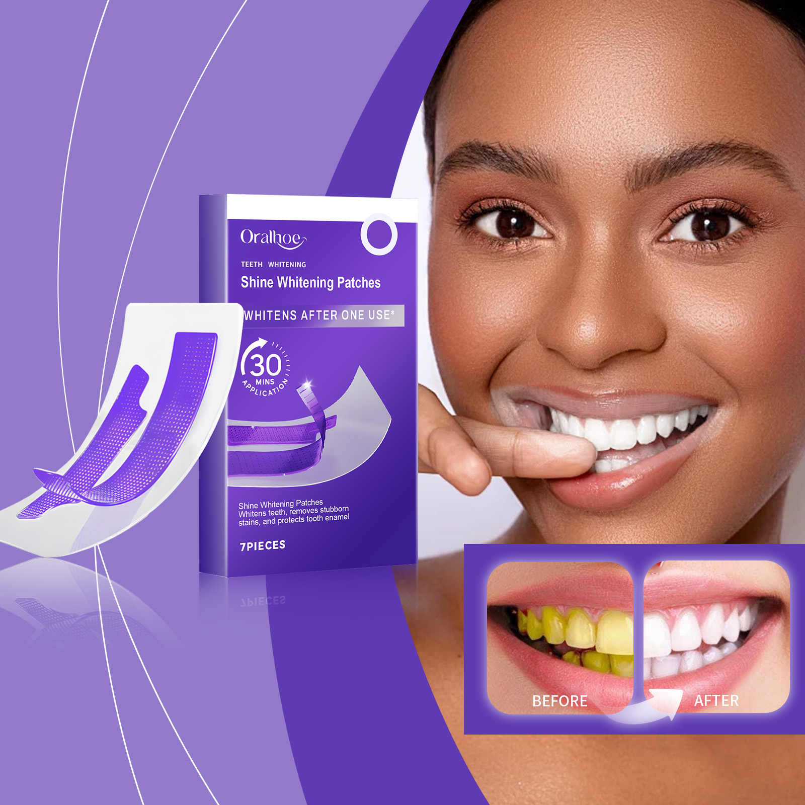 Purple Teeth Whitening Strips  - Teeth Whitening Quotes reseña y precio
