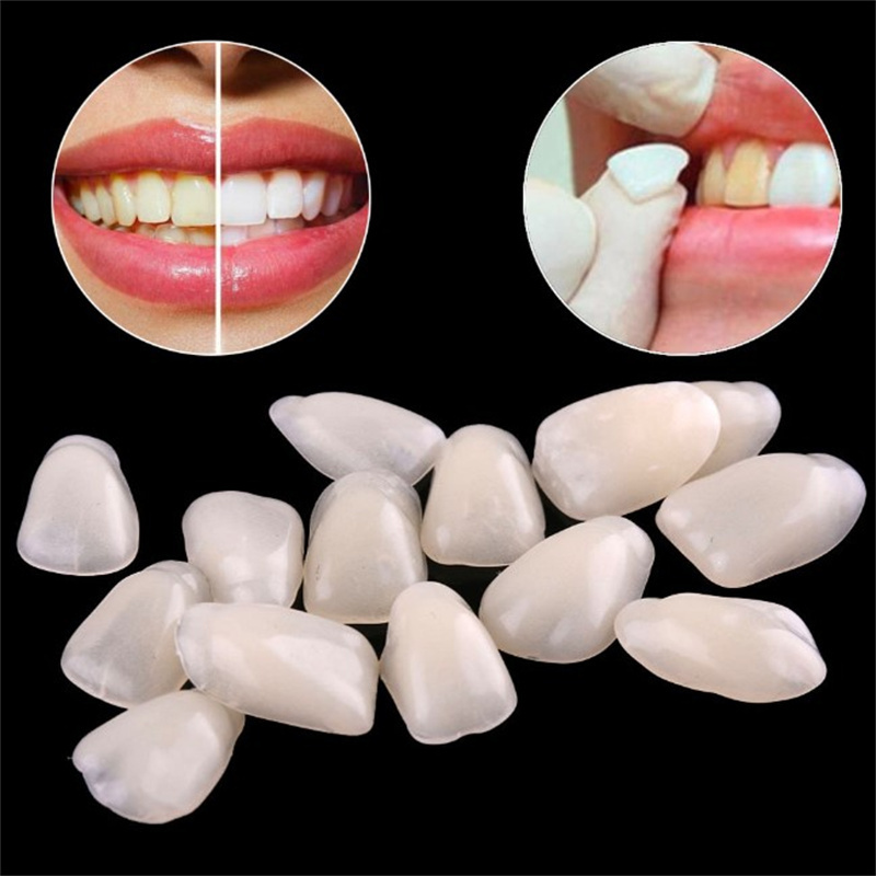 Temporary Dental Veneers - Ult - Teeth Whitening Veneers reseña y precio
