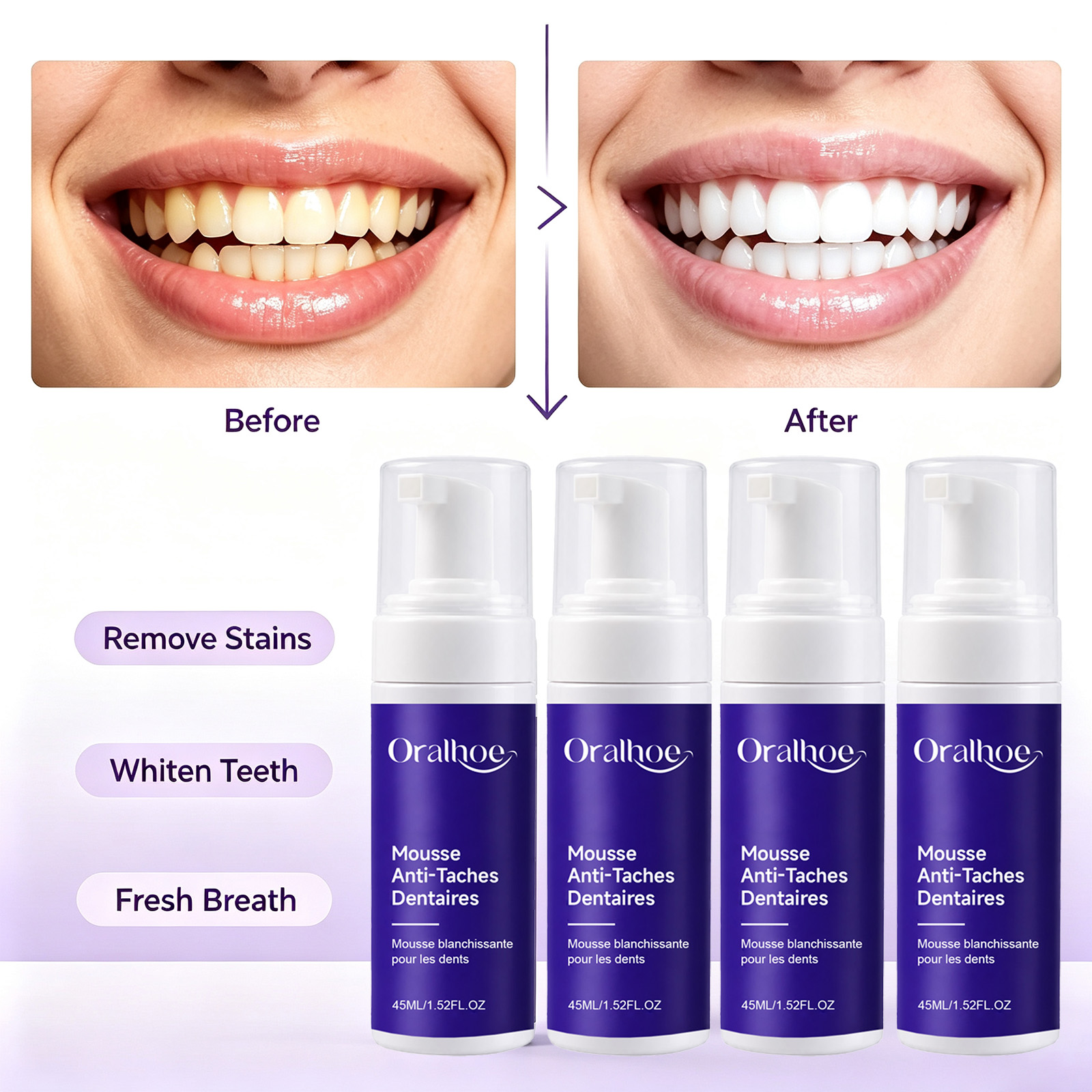 Purple Foaming Teeth Whitening - Teeth Whitening Routine reseña y precio