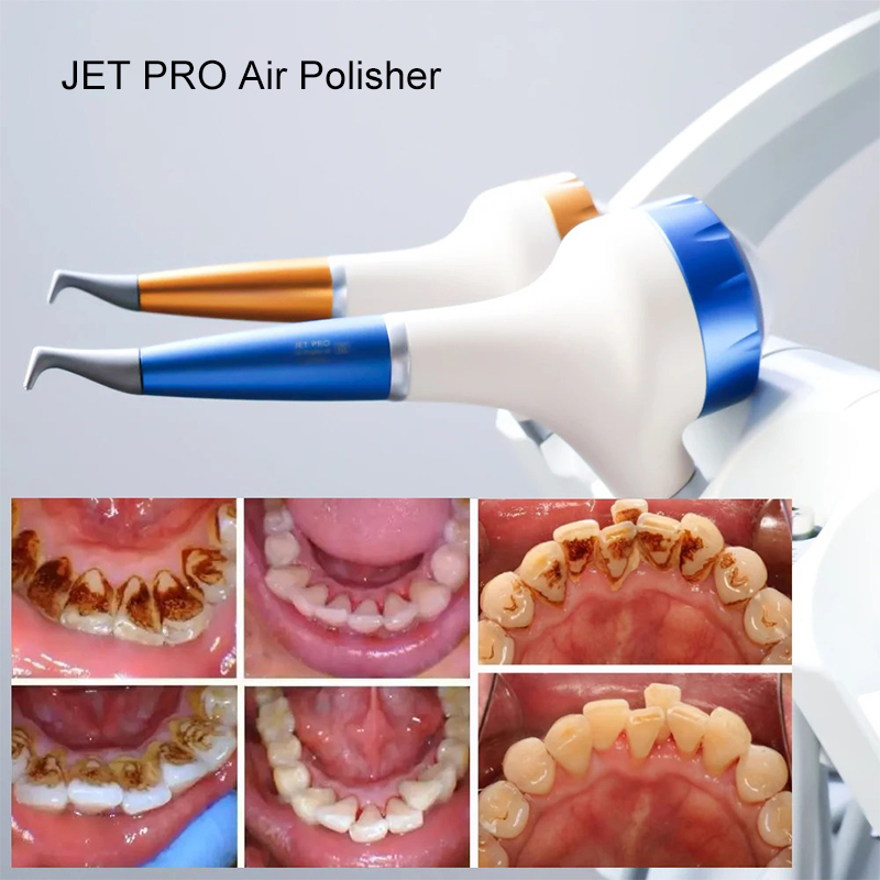 VV Dental  Air Polishing Proph - Teeth Whitening Usa reseña y precio