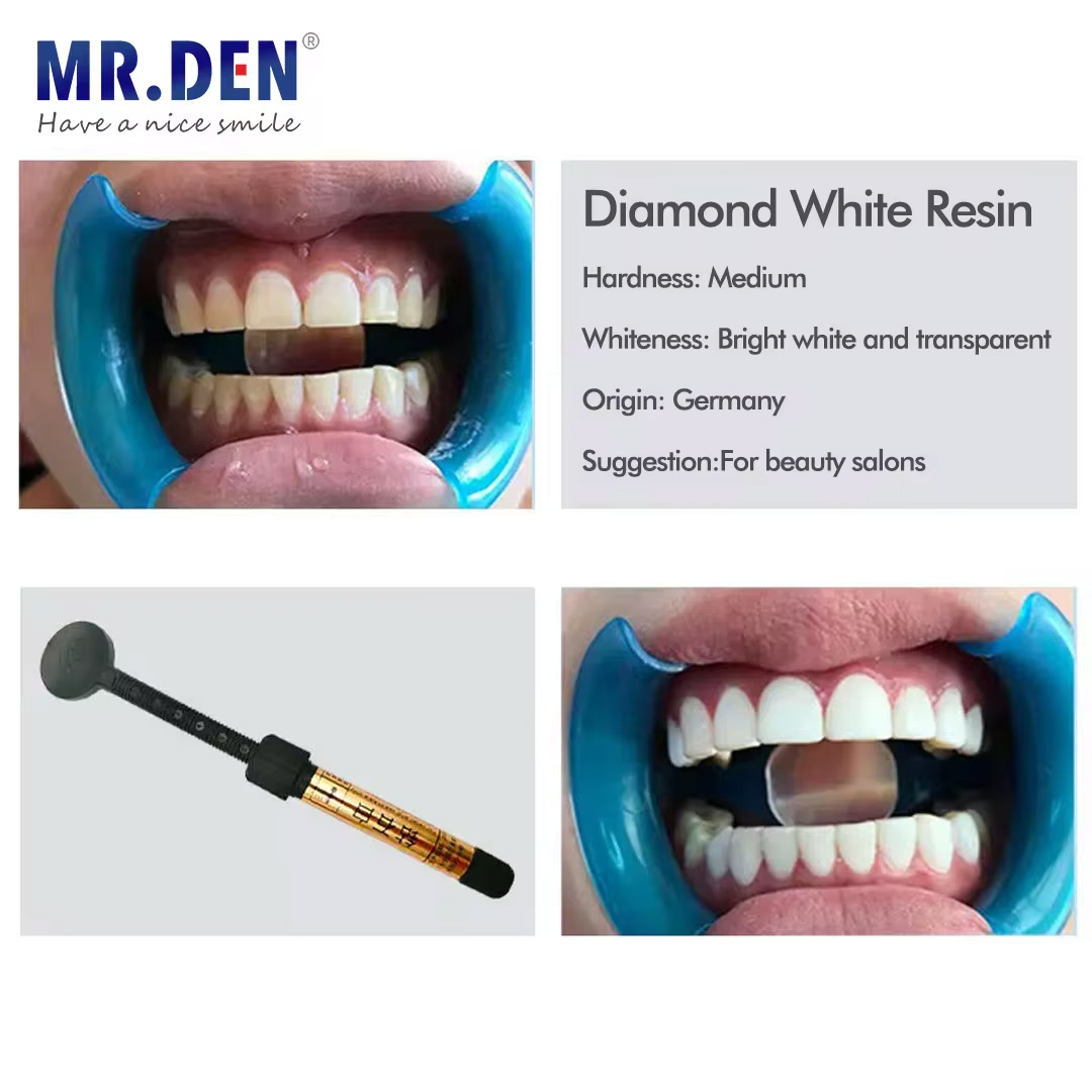 Nano enamel veneer material te - Teeth Whitening Veneers reseña y precio
