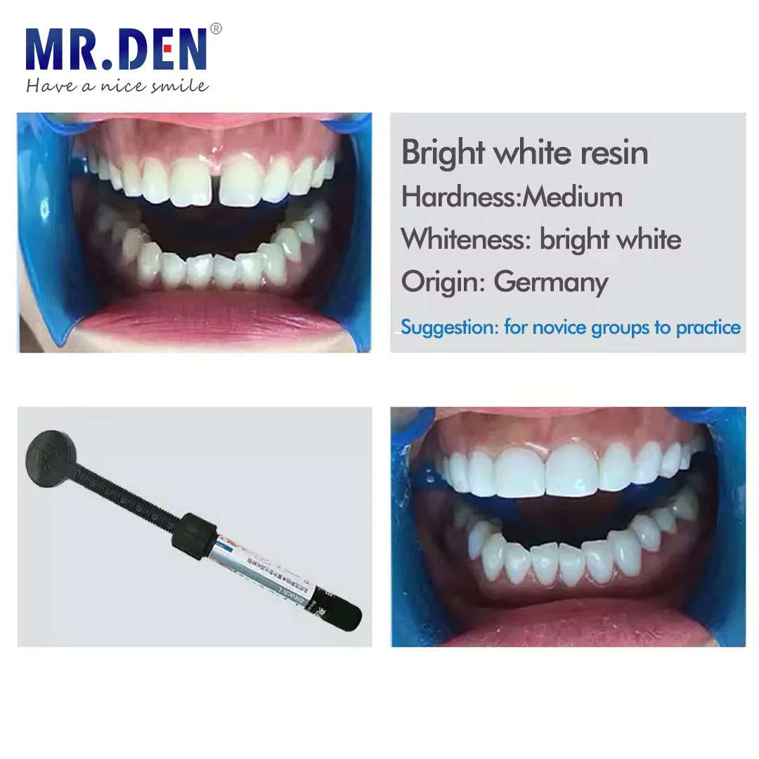 Nano enamel veneer material te - Teeth Whitening Veneers reseña y precio