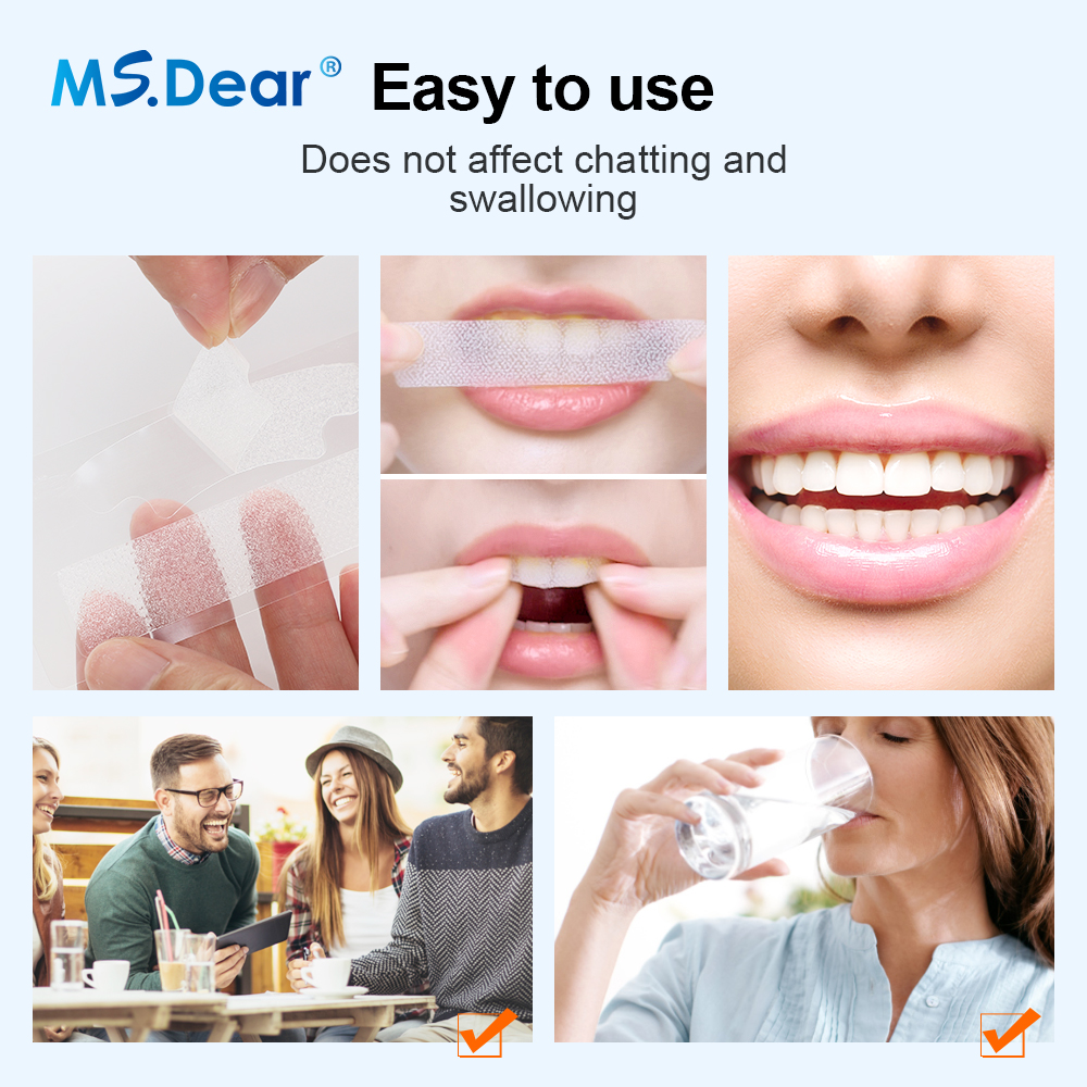 7/14/21/28/70 Pairs 9D Gel Tee - Teeth Whitening Hydrogen Peroxide reseña y precio