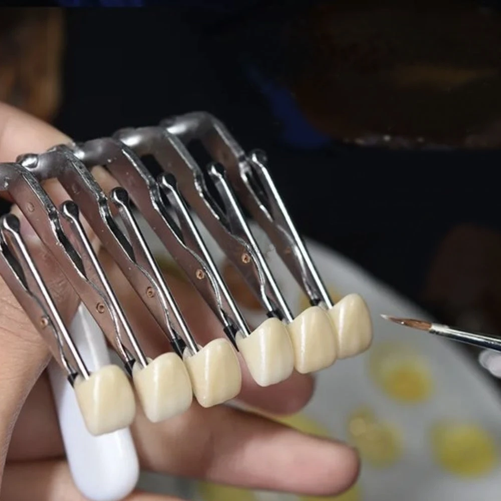 1pc Dental Veneer Porcelain Fa - Teeth Whitening Veneers reseña y precio